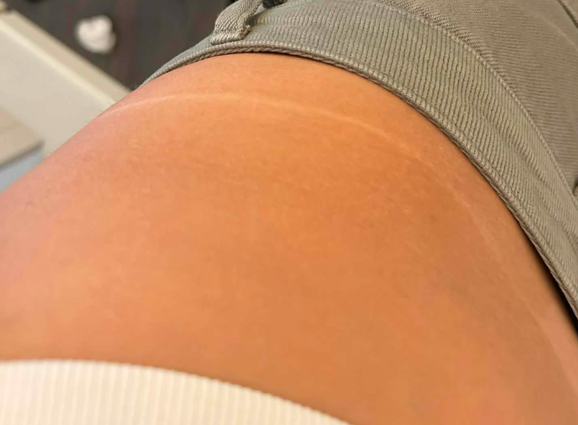 Glow Lab resultat – Naturlig, jævn glød